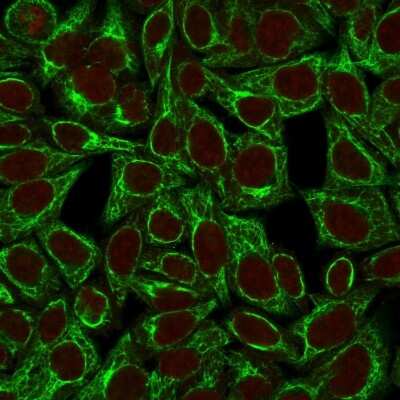 Immunocytochemistry/ Immunofluorescence: Cytokeratin 8 Antibody (TS1) [NBP2-34267]