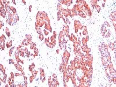 Immunohistochemistry-Paraffin: Cytokeratin, Basic (Type II or HMW) Antibody (SPM116) - Azide and BSA Free [NBP2-34395]