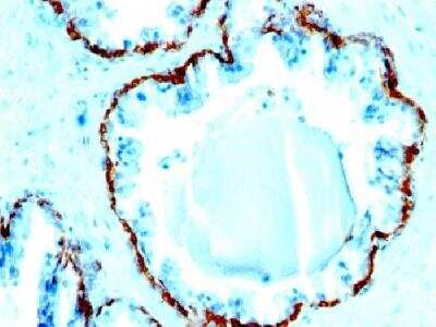 Immunohistochemistry-Paraffin: Cytokeratin, Basic (Type II or HMW) Antibody (SPM591) [NBP2-34388]