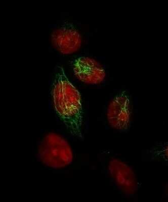 Immunocytochemistry/ Immunofluorescence: Cytokeratin, HMW Antibody (34BE12) [NBP2-34340]