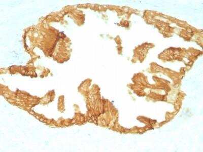 Immunohistochemistry-Paraffin: Cytokeratin, HMW Antibody (KRTH/1076) - Azide and BSA Free [NBP2-47690]