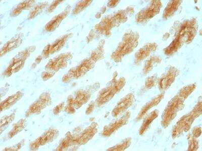 Immunohistochemistry-Paraffin: Cytokeratin, HMW Antibody (KRTH/1076) - IHC-Prediluted [NBP2-48266]