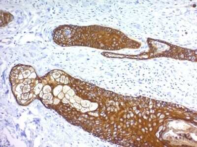 Immunohistochemistry-Paraffin: Cytokeratin, HMW Antibody (KRTH/1076) [NBP2-44440]