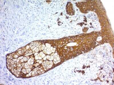 Immunohistochemistry-Paraffin: Cytokeratin, HMW Antibody (KRTH/1576R) - Azide and BSA Free [NBP2-54589]