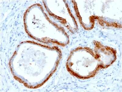 Immunohistochemistry-Paraffin: Cytokeratin, HMW Antibody (KRTH/2147R) [NBP3-07272]
