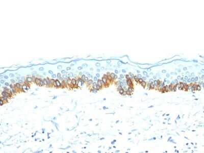 Immunohistochemistry-Paraffin: Cytokeratin, LMW Antibody (AE-1) - Azide and BSA Free [NBP2-33178]