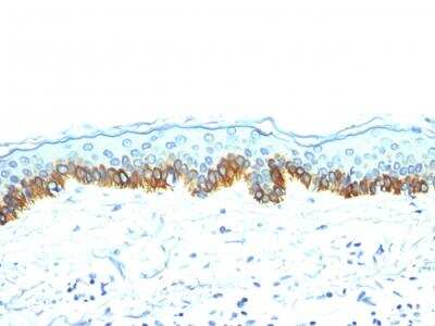 Immunohistochemistry-Paraffin: Cytokeratin, LMW Antibody (AE-1) - IHC-Prediluted [NBP2-48267]