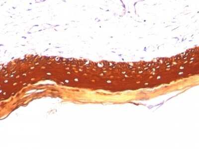 Immunohistochemistry-Paraffin: Cytokeratin, LMW Antibody (KRTL/1077) [NBP2-44373]
