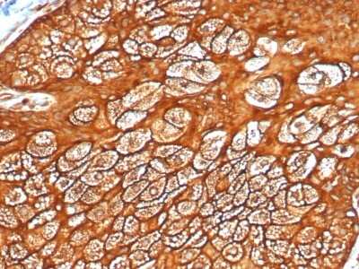 Immunohistochemistry-Paraffin: Cytokeratin, LMW Antibody (KRTL/4440R) - Azide and BSA Free [NBP3-08422]