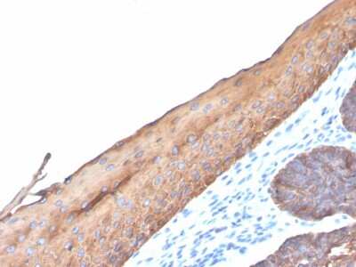 Immunohistochemistry-Paraffin: Cytokeratin, LMW Antibody (KRTL/4440R) [NBP3-07287]