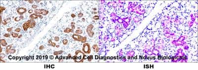 Detection of Cytokeratin, pan in Human Tissue in Dual RNAscope ISH-IHC