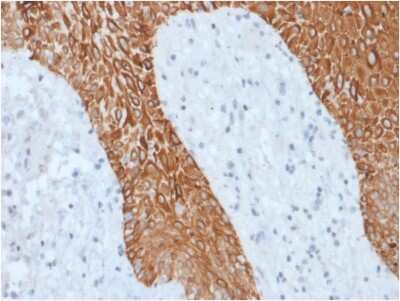Immunohistochemistry-Paraffin: Cytokeratin, pan Antibody (KRT/1877R) - Azide and BSA Free [NBP3-08398]