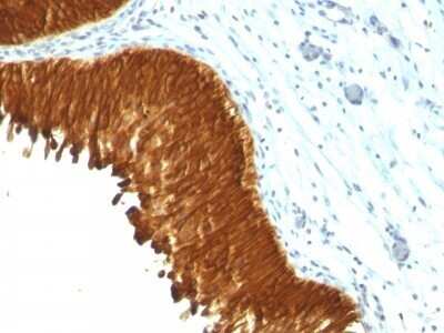 Immunohistochemistry-Paraffin: Cytokeratin, pan Antibody (KRT/457) [NBP2-45309]