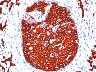 Immunohistochemistry-Paraffin: Cytokeratin, pan Antibody (KRTL/1077 + KRTH/1076) - IHC-Prediluted [NBP2-48299]