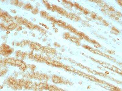Immunohistochemistry-Paraffin: Cytokeratin, pan Antibody (KRTL/1077 + KRTH/1076) - IHC-Prediluted [NBP2-48299]