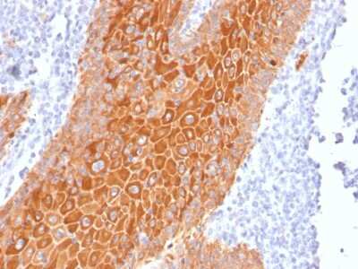 Immunohistochemistry-Paraffin: Cytokeratin, pan Antibody (PAN-CK (Cocktail)) - Azide and BSA Free [NBP2-76425]