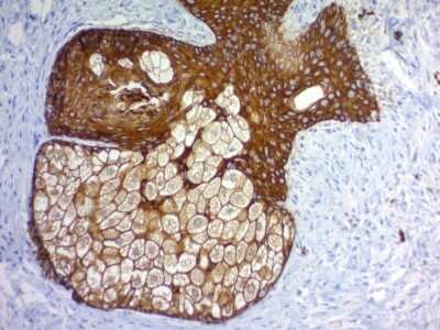 Immunohistochemistry-Paraffin: Cytokeratin, pan Antibody (PAN-CK (Cocktail)) - IHC-Prediluted [NBP2-48300]