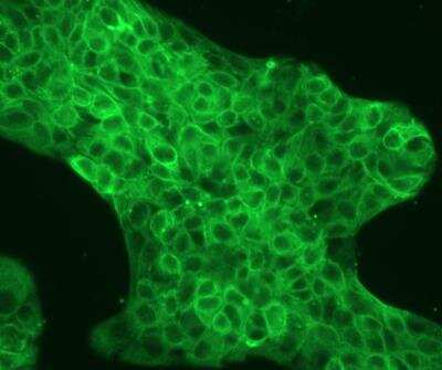 Immunocytochemistry/ Immunofluorescence: Cytokeratin, pan Antibody (PCK-26) [NB120-6401]