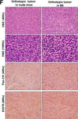 Immunohistochemistry: Cytokeratin, pan Antibody (PCK-26) [NB120-6401]