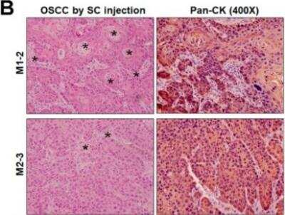 Immunohistochemistry: Cytokeratin, pan Antibody (PCK-26) [NB120-6401]