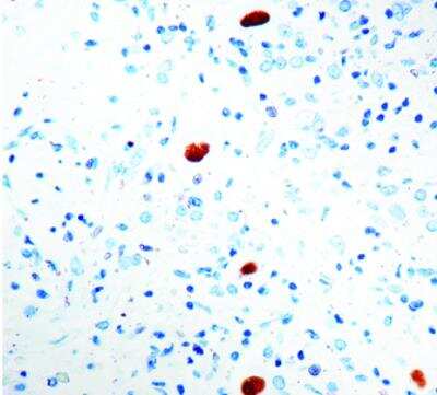 Immunohistochemistry-Paraffin: Cytomegalovirus Antibody (DDG9 and CCH2) [NBP1-22532]