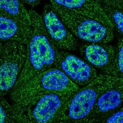 Immunocytochemistry/ Immunofluorescence: Cytosol Nonspecific Dipeptidase (CNDP2)/CPGL Antibody [NBP2-38338]