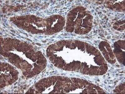 Immunohistochemistry: Cytosol Nonspecific Dipeptidase (CNDP2)/CPGL Antibody (OTI8A2) - Azide and BSA Free [NBP2-72019]