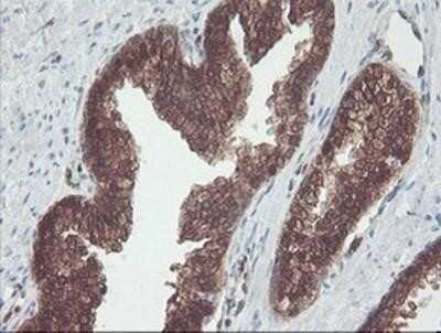 Immunohistochemistry: Cytosol Nonspecific Dipeptidase (CNDP2)/CPGL Antibody (OTI8A2) - Azide and BSA Free [NBP2-72019]