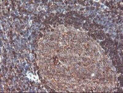 Immunohistochemistry: Cytosol Nonspecific Dipeptidase (CNDP2)/CPGL Antibody (OTI8A2) - Azide and BSA Free [NBP2-72019]