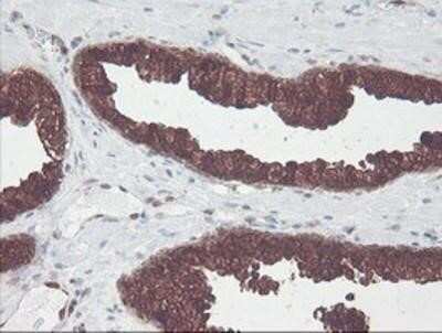 Immunohistochemistry-Paraffin: Cytosol Nonspecific Dipeptidase (CNDP2)/CPGL Antibody (OTI8A2) [NBP2-00953]