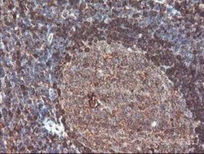 Immunohistochemistry-Paraffin: Cytosol Nonspecific Dipeptidase (CNDP2)/CPGL Antibody (OTI8A2) [NBP2-00953]