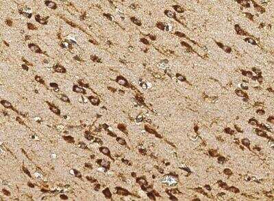 Immunohistochemistry-Paraffin: Cytosolic Sulfotransferase 1A1/SULT1A1 Antibody (034) [NBP2-89950]