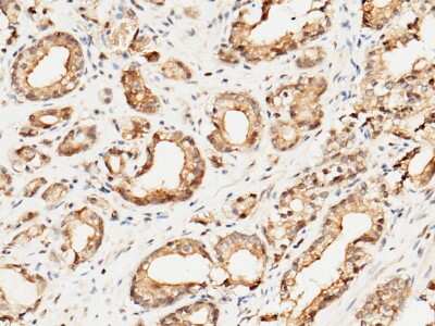 Immunohistochemistry-Paraffin: Cytosolic Sulfotransferase 1A1/SULT1A1 Antibody [NBP2-99855]