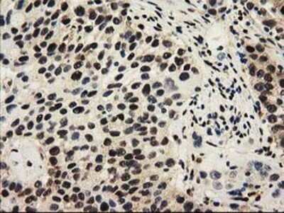 Immunohistochemistry: Cytosolic Sulfotransferase 1A1/SULT1A1 Antibody (OTI9B7) - Azide and BSA Free [NBP2-71308]