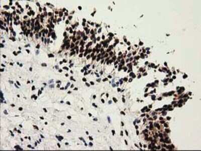 Immunohistochemistry: Cytosolic Sulfotransferase 1A1/SULT1A1 Antibody (OTI9B7) - Azide and BSA Free [NBP2-71308]