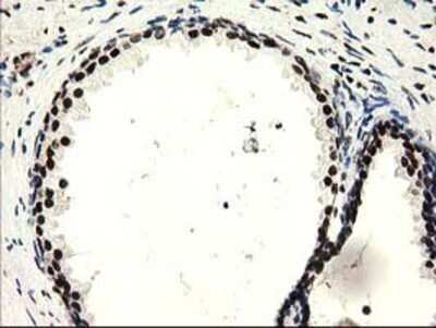 Immunohistochemistry: Cytosolic Sulfotransferase 1A1/SULT1A1 Antibody (OTI9B7) - Azide and BSA Free [NBP2-71308]