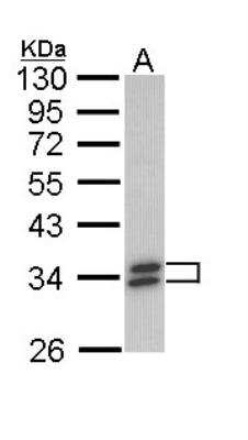 Western Blot: Cytosolic Sulfotransferase 1A1/SULT1A1 Antibody [NBP1-33550]