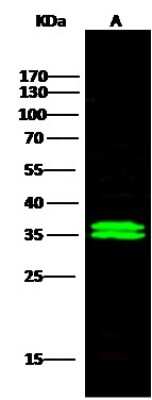 Western Blot: Cytosolic Sulfotransferase 1A1/SULT1A1 Antibody [NBP2-99855]