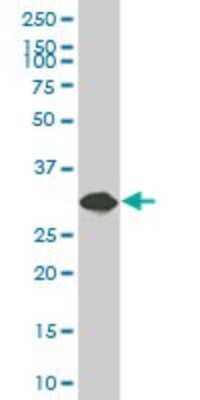Western Blot: SULT1A3 Antibody [H00006818-B01P]