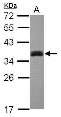 Western Blot: SULT1A3 Antibody [NBP1-31809]