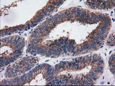 Immunohistochemistry: Cytosolic Sulfotransferase 1C2/SULT1C2 Antibody (OTI4G1) - Azide and BSA Free [NBP2-71313]