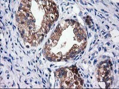 Immunohistochemistry: Cytosolic Sulfotransferase 1C2/SULT1C2 Antibody (OTI4G1) - Azide and BSA Free [NBP2-71313]