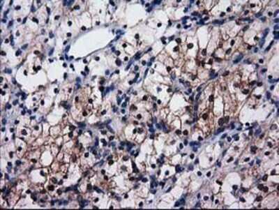 Immunohistochemistry: Cytosolic Sulfotransferase 1C2/SULT1C2 Antibody (OTI4G1) - Azide and BSA Free [NBP2-71313]