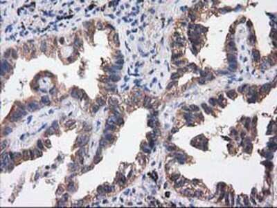 Immunohistochemistry: Cytosolic Sulfotransferase 1C2/SULT1C2 Antibody (OTI4G1) - Azide and BSA Free [NBP2-71313]
