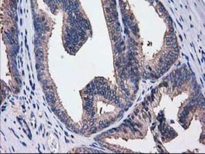 Immunohistochemistry: Cytosolic Sulfotransferase 1C2/SULT1C2 Antibody (OTI4G1) - Azide and BSA Free [NBP2-71313]