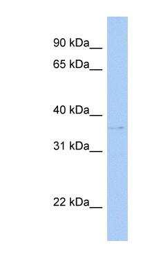 Western Blot: Cytosolic Sulfotransferase 1C2/SULT1C2 Antibody [NBP1-53102]
