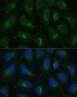Immunocytochemistry/ Immunofluorescence: Cytosolic Sulfotransferase 1C4/SULT1C4 Antibody - Azide and BSA Free [NBP2-92233]