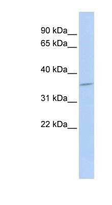 Western Blot: Cytosolic Sulfotransferase 1C4/SULT1C4 Antibody [NBP1-52893]