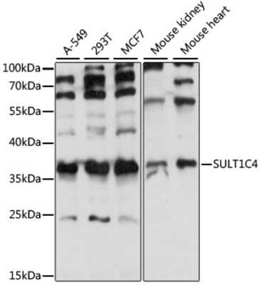 Western Blot: Cytosolic Sulfotransferase 1C4/SULT1C4 AntibodyAzide and BSA Free [NBP2-92233]