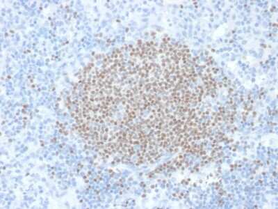Immunohistochemistry-Paraffin: Cytosolic Sulfotransferase 1E1/SULT1E1 Antibody (CPTC-SULT1E1-1) - Azide and BSA Free [NBP3-08212]